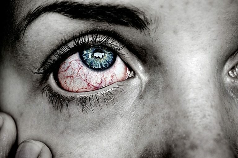 Синдром сухого глаза: причины, симптомы и методы лечения