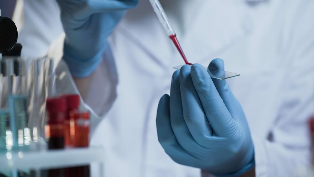 Анализы крови на рак: лабораторные тесты